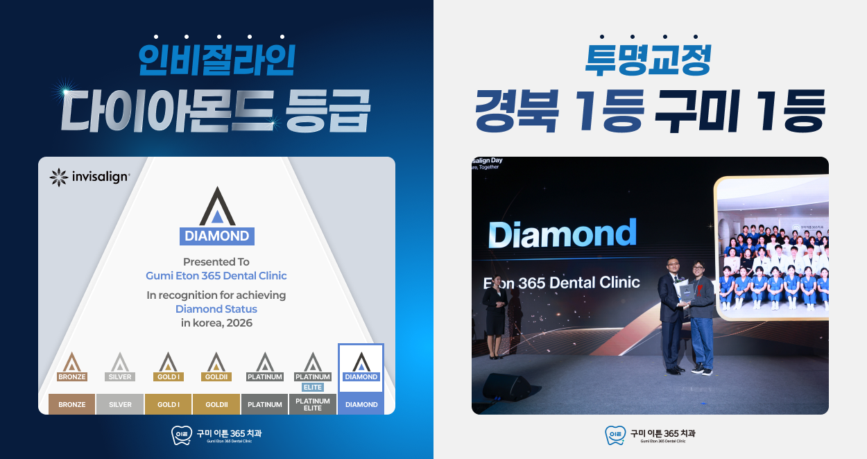 인비절라인 다이아몬드 등급